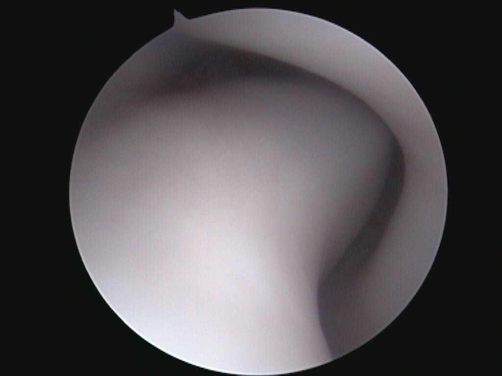 endoscopia diagn1 bild